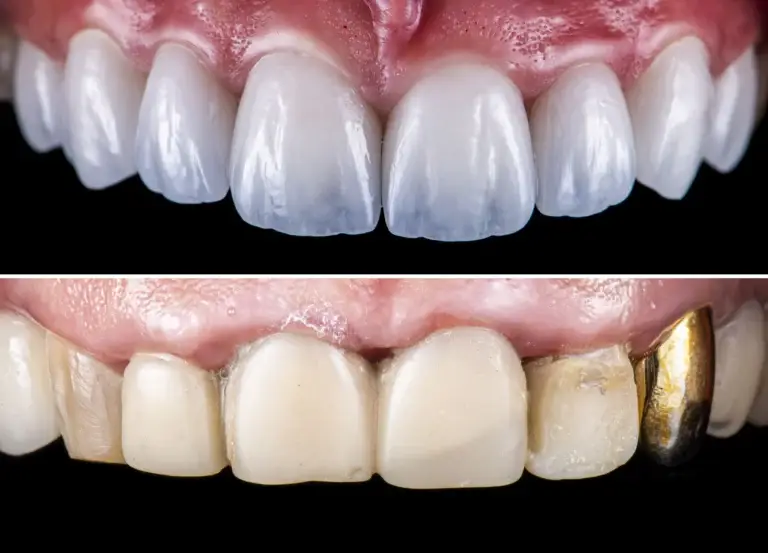 topdentis-cologne-zahnarzt-fuer-angstpatienten-koeln-zahnersatz