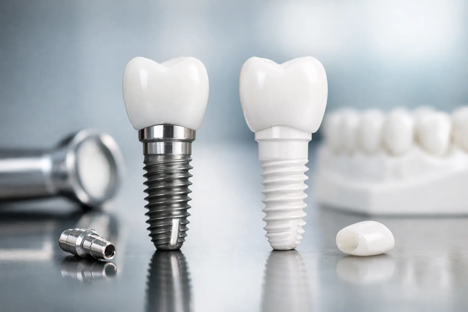 Titan oder Keramikimplantat - was passt?